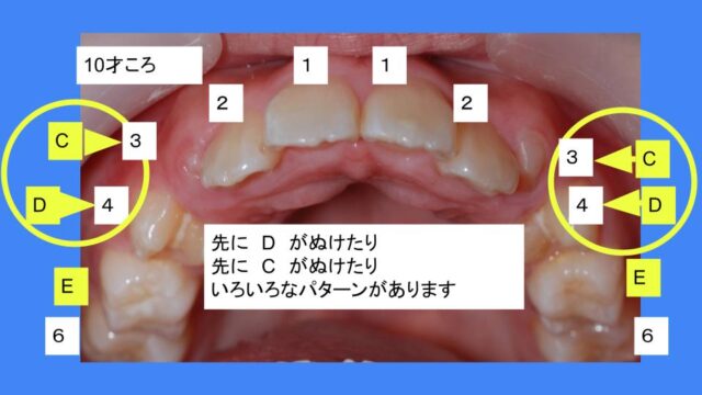 4番目に交換する歯 １０才ころ はえかわり中の治療なら池田歯科医院